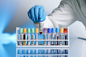 Laboratory-developed tests